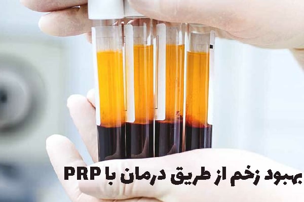 درمان زخم با پی آر پی