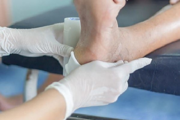 لارو تراپی در درمان زخم پای دیابتی